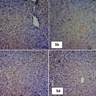 GPx Immunostaining 40X Photomicrograph Of Section Of Liver Of Mice