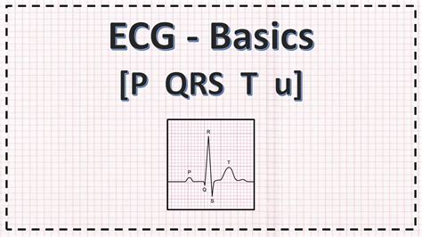 Ecg Waves Ecg From Basics Pqrst U Youtube