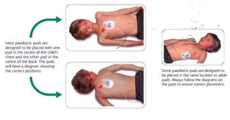 Resuscitation With An AED First Aid Training