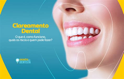 Clareamento Dental O que é como funciona quais os riscos e quem pode