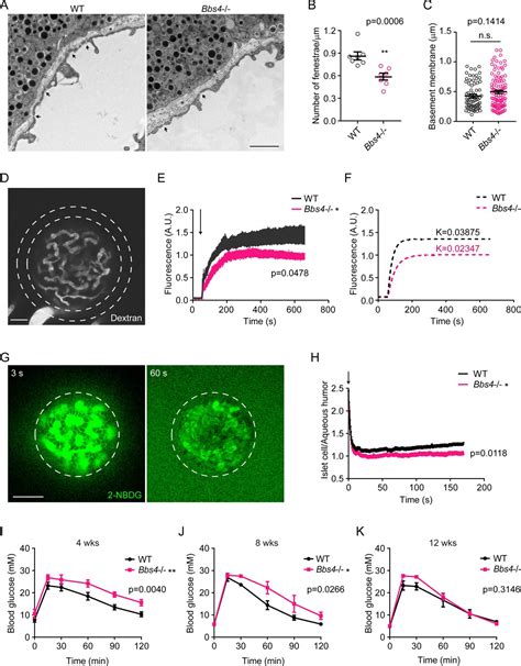 Islet Vascularization Is Regulated By Primary Endothelial Cilia Via