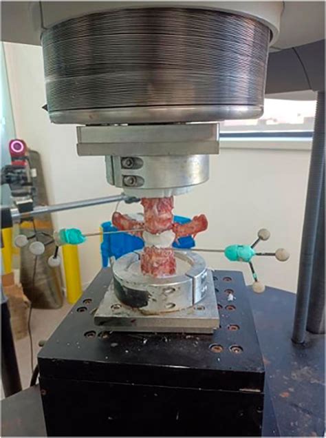 Frontiers Biomechanical Analysis Of A Novel Bone Cement Bridging