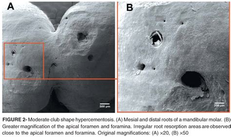 Scielo Brasil A Scanning Electron Microscopic Study Of