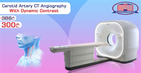 Carotid Artery Ct Angiography With Dynamic Contrast National Surgery