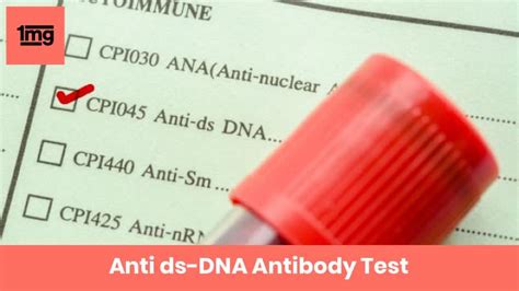 Anti Ds Dna Antibody Purpose And Normal Range Of Results 1mg