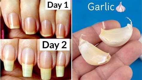 How To Grow Nails In 2 Days How To Grow Nails Fast Be Natural