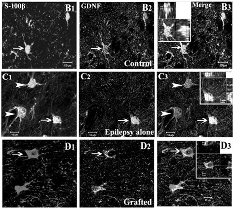 Figure 5 The Medial Ganglionic Eminence Derived Neural Stem Cell Mge