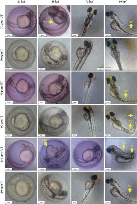 A Photomicrograph Representing Morphological Abnormalities In