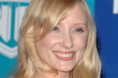 Us Actress Anne Heche In Critical Condition After La Vehicle