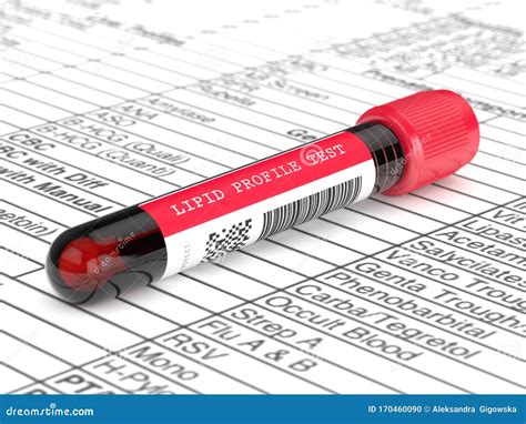 D Render With Lipid Profile Test Blood Sample Stock Illustration