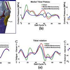 A D Subject Specific Knee Joint Model B C Maximum Values Of