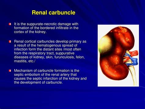 Carbuncle Causes Signs Symptoms Prevention Diagnosis