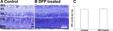 The Oral Iron Chelator Deferiprone Protects Against Iron Overload