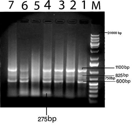 Agarose Gel Electrophoresis Of Pcr Product From Pancreatic Tissue In