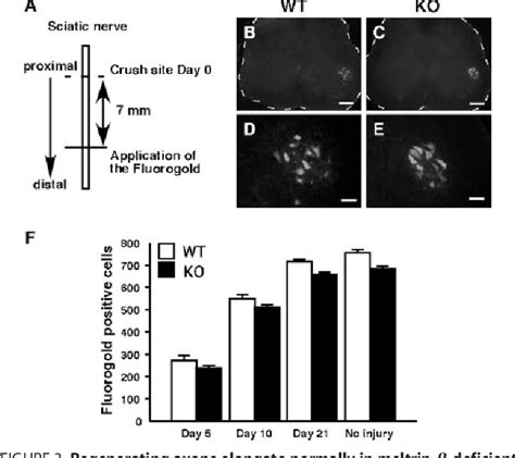 Figure 3 from Roles of Meltrin β ADAM19 in Progression of Schwann Cell