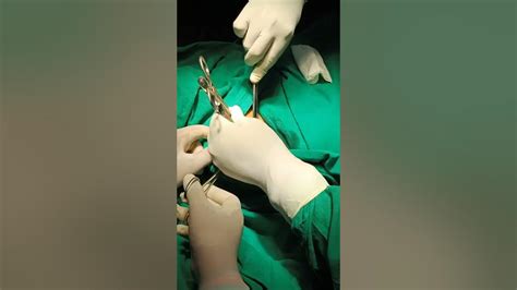 Cyst Excision Under Local Anaesthesia Part 3 Youtube