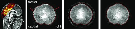 Examples Of Mri Images A Sagittal Slice Of T Weighted Mprage