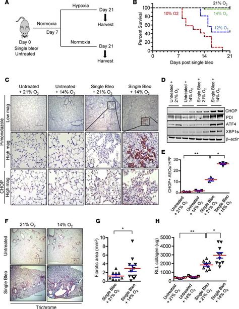 JCI Insight Localized Hypoxia Links ER Stress To Lung Fibrosis