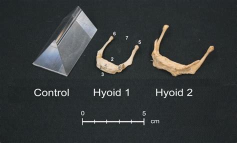 Hyoid Bone Development An Assessment Of Optimal Ct Scanner Parameters And Three‐dimensional