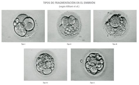 Cómo se valora la calidad de los embriones en células Gravida