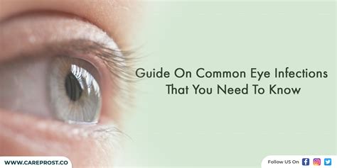 Guide On Common Eye Infections That You Need To Know