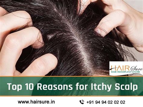 Top 48 image itchy scalp and hair loss - Thptnganamst.edu.vn