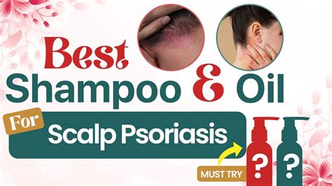 Scalp Psoriasis Ke Liye Sabse Acha Shampoo Aur Oil Best Shampoo And Oil For Scalp Psoriasis