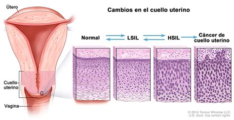 Significado De Los Cambios En El Cuello Uterino Guía Para La Salud De