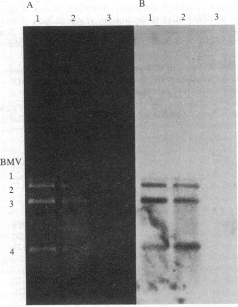 A Ethidium Bromide Stained 1 Agarose Gel After Electrophoresis Of