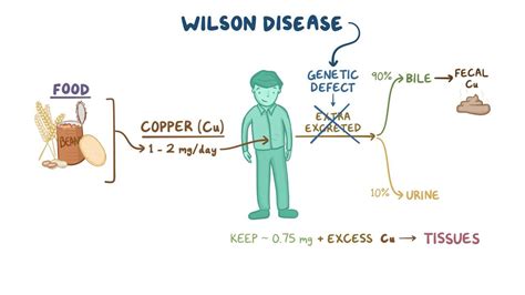 Wilson Disease