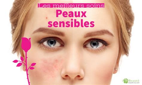 Les meilleurs soins anti rougeurs couperose rosacée ou peau sensible