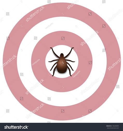 Lyme Disease Bulls Eye Rash Tick Insect Graphic Illustration Isolated On White 146284895