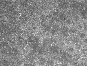 SEM microphotograph of textured surface wafer | Download Scientific Diagram 