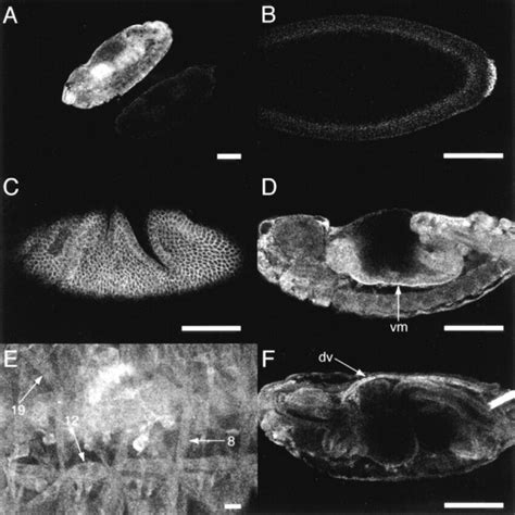 Spatial Expression Pattern Of Mbc In Wild Type Embryos Anterior Is To Download Scientific