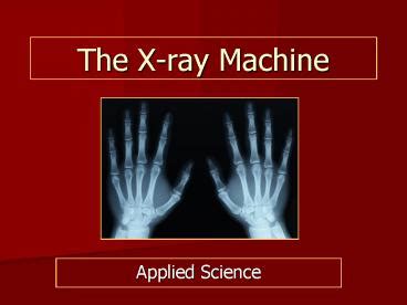 PPT The Xray Machine PowerPoint Presentation Free To View Id