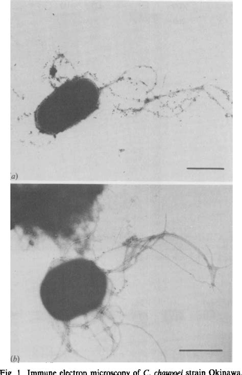 Figure 1 From Antigenic Analysis Of Clostridium Chauvoei Flagella With