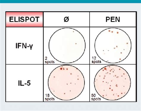 Enzyme Linked Immunospot Elispot Assay For The Detection Of