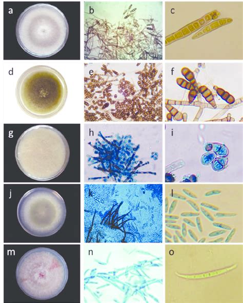 Características Macroscópicas Y Microscópicas De Los Hongos