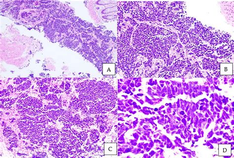 Normal Prostate Histology