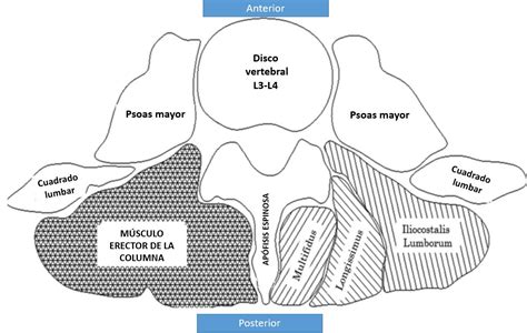 Músculo Cuadrado Lumbar Dolopedia