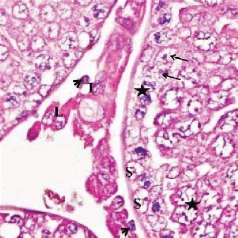 Photomicrograph Of Section In Testis Of Group Iiib Showing Germ Cells