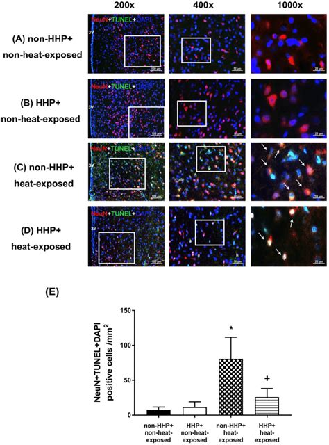 Photographs Of Immunofluorescence Staining Of Hypothalamic Apoptotic