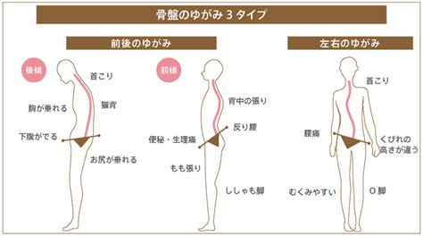 産後骨盤矯正が必要な理由とは？？？ ひなた整骨院