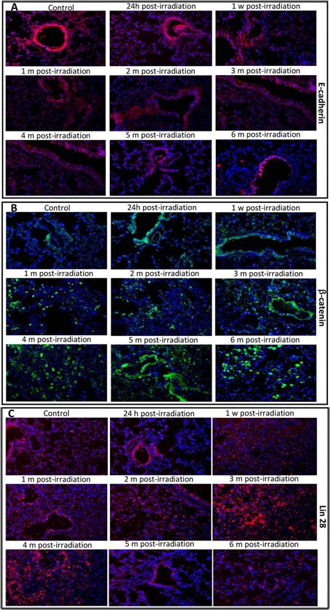 The images of immunofluorescence staining of the E cadherin β catenin