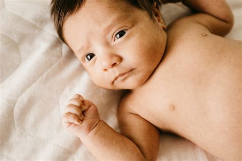 Nesselsucht Bei Kindern Urtikaria Schnelle Hilfe Bei Ausschlag