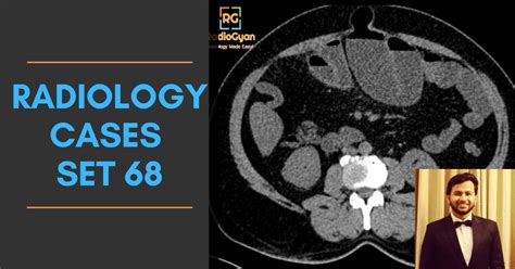 Category Spotters Cases Radiogyan