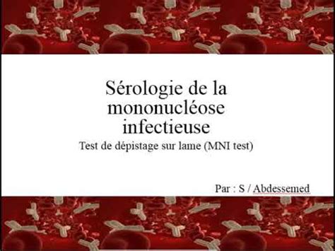 Sérologie de la mononucléose infectieuse Test de dépistage sur lame