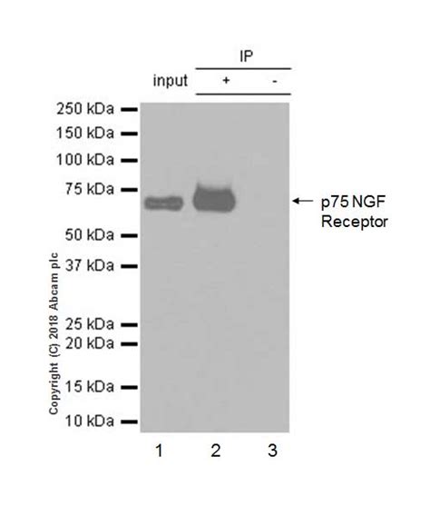 Anti P Ngf Receptor Antibody Ep Y Low Endotoxin Azide Free