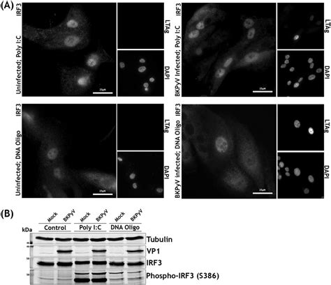 Bkpyv And Mock Infected Rpte Cells Do Not Differ In Their Responses To