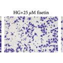 Chemical Structure Of Fisetin And Its Effect On The Viability Of